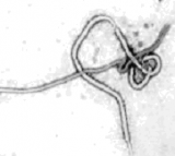 Ebola virus